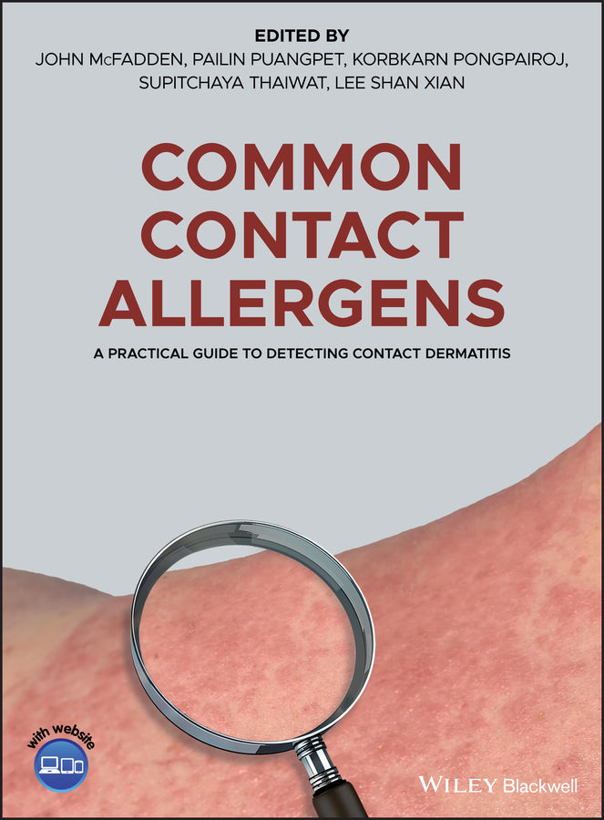 Common Contact Allergens; A Practical Guide to Detecting Contact Dermatitis (Hardback) 9781119405665