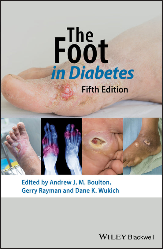 The Foot in Diabetes (Hardback) 9781119445814