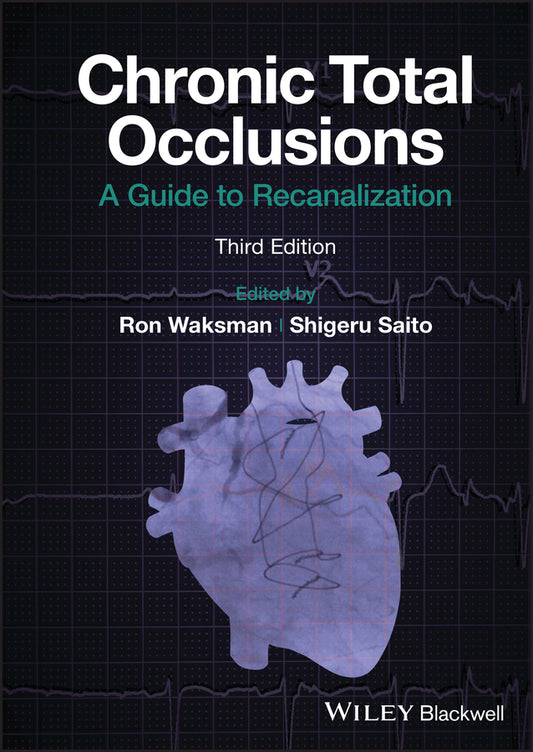 Chronic Total Occlusions; A Guide to Recanalization (Hardback) 9781119517276