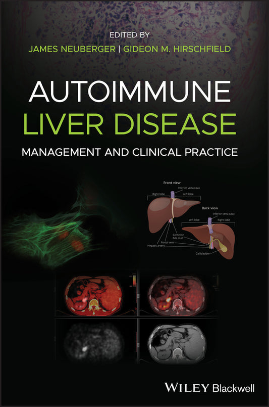 Autoimmune Liver Disease; Management and Clinical Practice (Hardback) 9781119532606