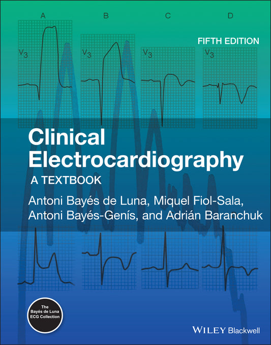 Clinical Electrocardiography; A Textbook (Hardback) 9781119536451