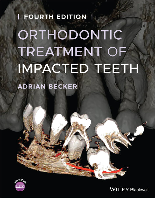 Orthodontic Treatment of Impacted Teeth (Hardback) 9781119565376