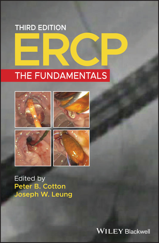 ERCP; The Fundamentals (Hardback) 9781119601098
