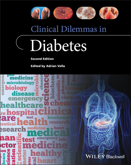 Clinical Dilemmas in Diabetes (Paperback / softback) 9781119603160