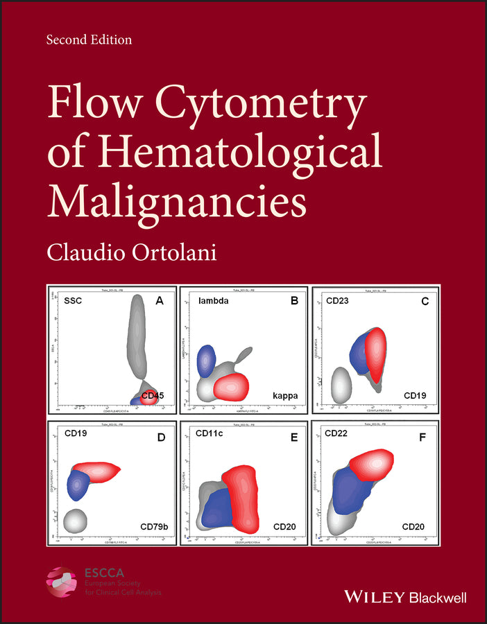 Flow Cytometry of Hematological Malignancies (Hardback) 9781119611257