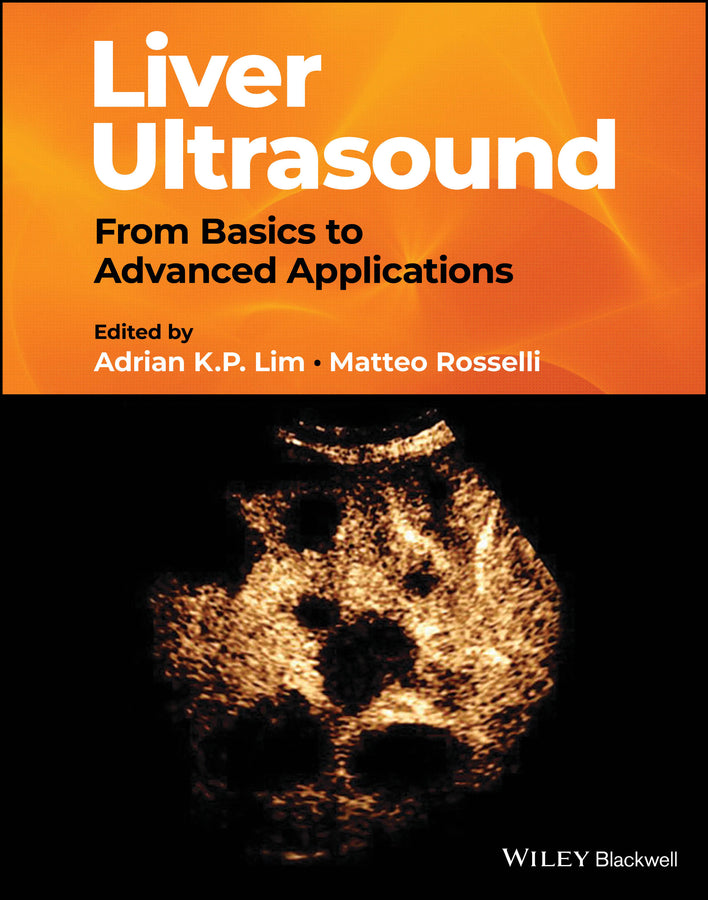 Liver Ultrasound; From Basics to Advanced Applications (Hardback) 9781119612599