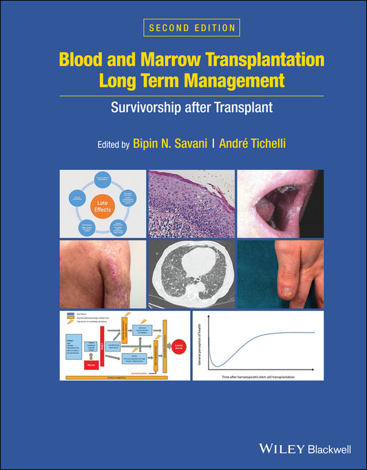 Blood and Marrow Transplantation Long Term Management; Survivorship after Transplant (Hardback) 9781119612698