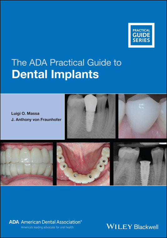 The ADA Practical Guide to Dental Implants (Paperback / softback) 9781119630692