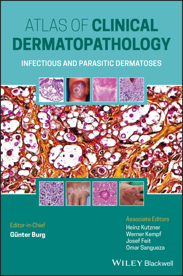 Atlas of Clinical Dermatopathology; Infectious and Parasitic Dermatoses (Hardback) 9781119647065