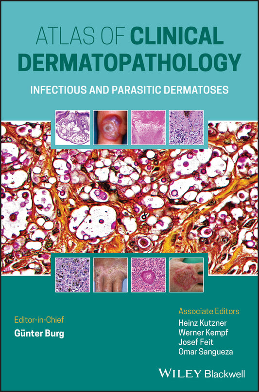 Atlas of Clinical Dermatopathology; Infectious and Parasitic Dermatoses (Hardback) 9781119647065