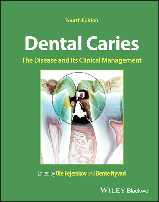 Dental Caries; The Disease and its Clinical Management (Hardback) 9781119679370