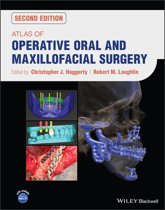Atlas of Operative Oral and Maxillofacial Surgery (Hardback) 9781119683810