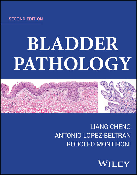 Bladder Pathology (Hardback) 9781119707554