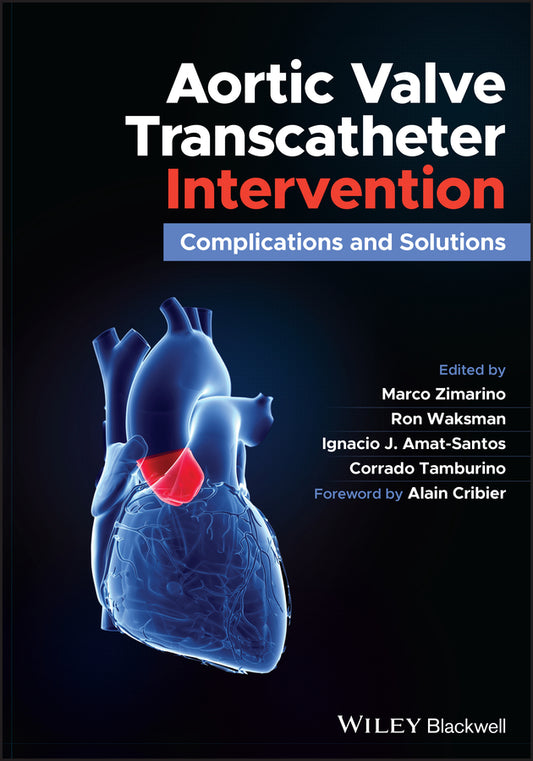Aortic Valve Transcatheter Intervention; Complications and Solutions (Hardback) 9781119720591