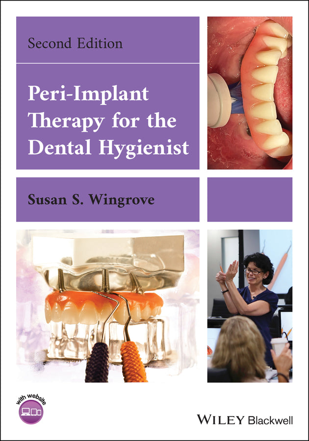 Peri-Implant Therapy for the Dental Hygienist (Paperback / softback) 9781119766186