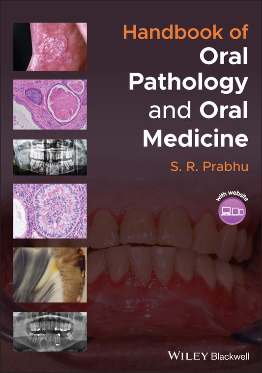 Handbook of Oral Pathology and Oral Medicine (Paperback / softback) 9781119781127