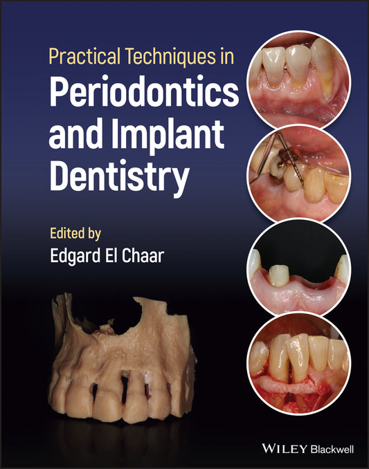 Practical Techniques in Periodontics and Implant Dentistry (Hardback) 9781119793557