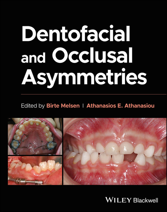Dentofacial and Occlusal Asymmetries (Hardback) 9781119794813