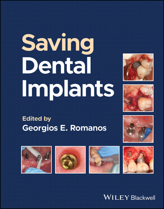 Saving Dental Implants (Hardback) 9781119807018