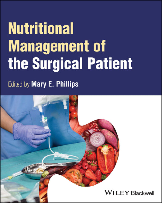 Nutritional Management of the Surgical Patient (Paperback / softback) 9781119809098