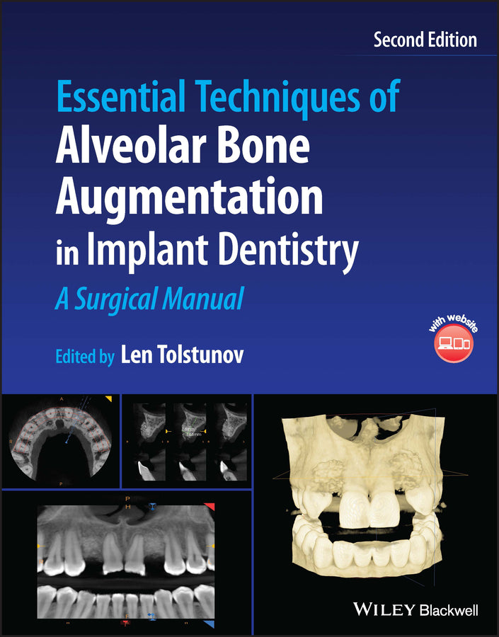 Essential Techniques of Alveolar Bone Augmentation in Implant Dentistry; A Surgical Manual (Hardback) 9781119827320