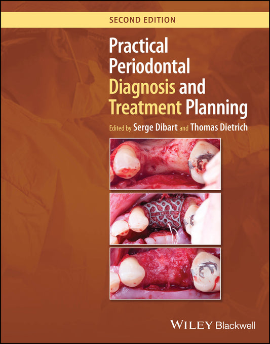 Practical Periodontal Diagnosis and Treatment Planning (Hardback) 9781119830313