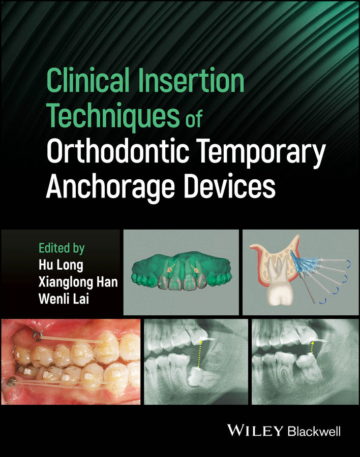 Clinical Insertion Techniques of Orthodontic Temporary Anchorage Devices (Hardback) 9781119892236