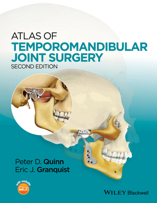 Atlas of Temporomandibular Joint Surgery (Hardback) 9781119949855