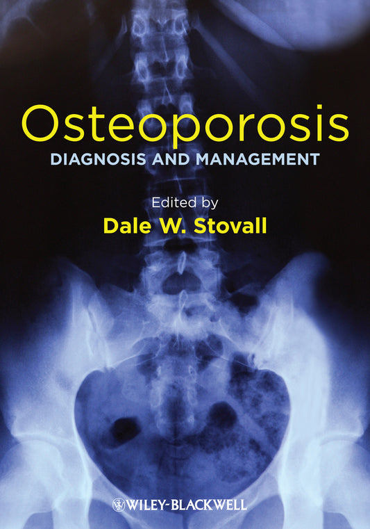 Osteoporosis; Diagnosis and Management (Hardback) 9781119968917