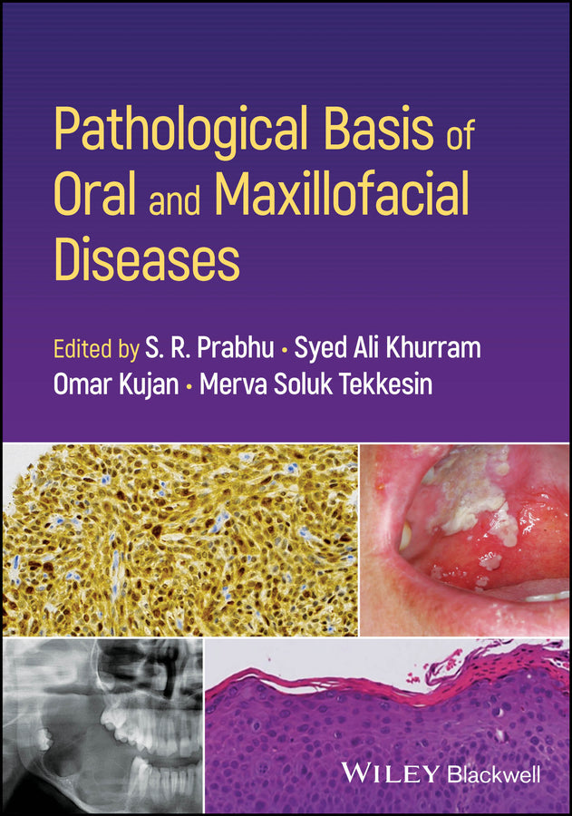 Pathological Basis of Oral and Maxillofacial Diseases (Paperback / softback) 9781119989202