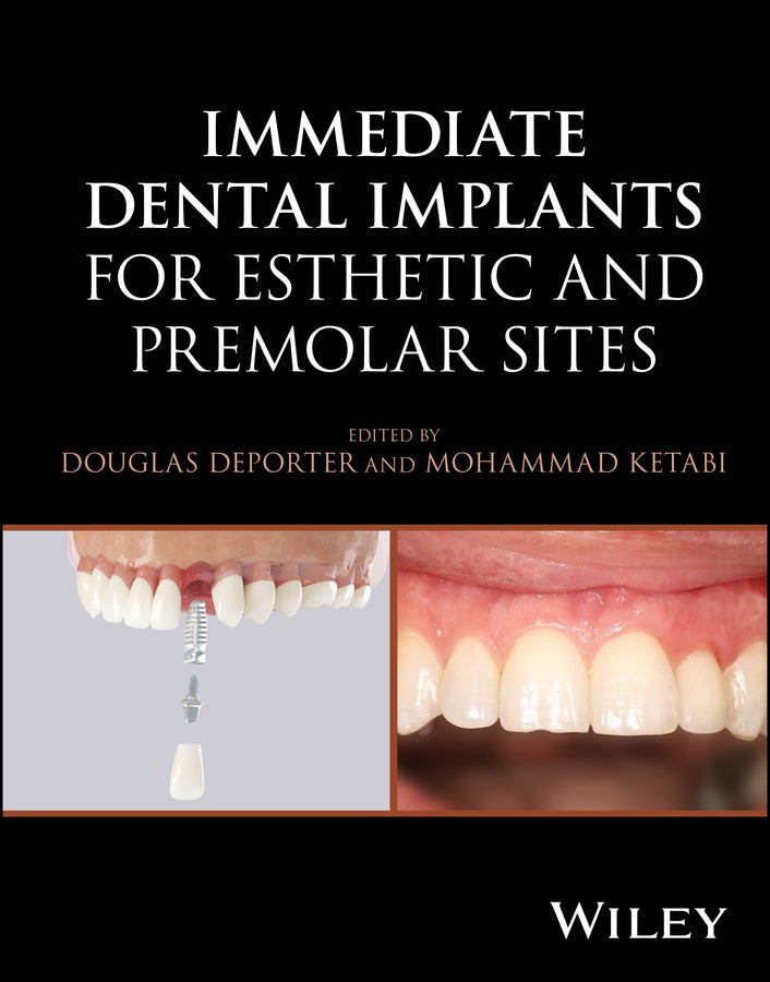 Immediate Dental Implants for Esthetic and Premolar Sites (Hardback) 9781394187102