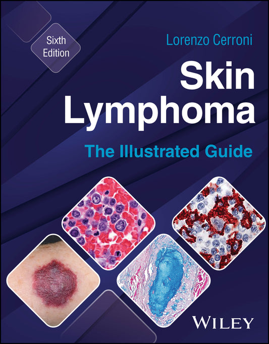Skin Lymphoma; The Illustrated Guide (Hardback) 9781394235483