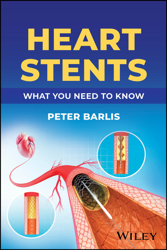 Heart Stents; What You Need to Know (Paperback / softback) 9781394266289