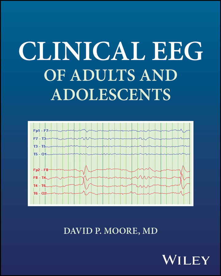 Clinical EEG of Adults and Adolescents (Paperback / softback) 9781394315345