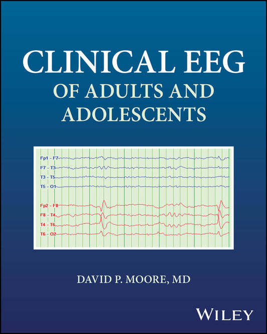 Clinical EEG of Adults and Adolescents (Paperback / softback) 9781394315345