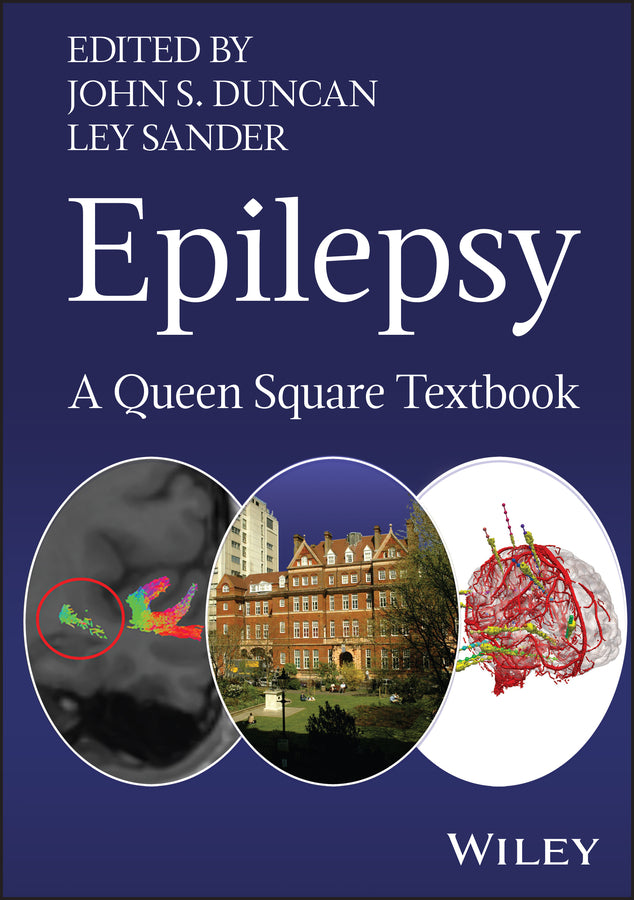 Epilepsy; A Queen Square Textbook (Hardback) 9781394340033