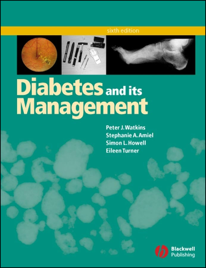 Diabetes and Its Management (Paperback / softback) 9781405107259