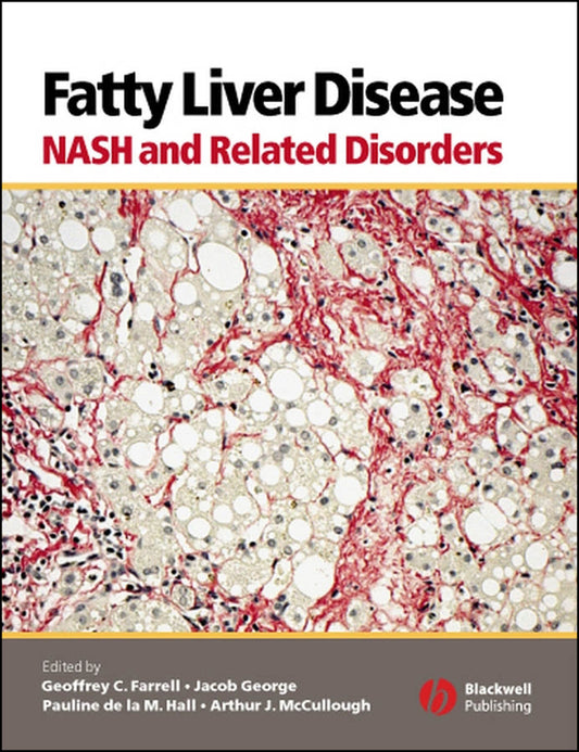 Fatty Liver Disease; NASH and Related Disorders (Hardback) 9781405112925