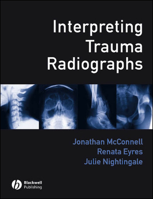 Interpreting Trauma Radiographs (Paperback / softback) 9781405115346
