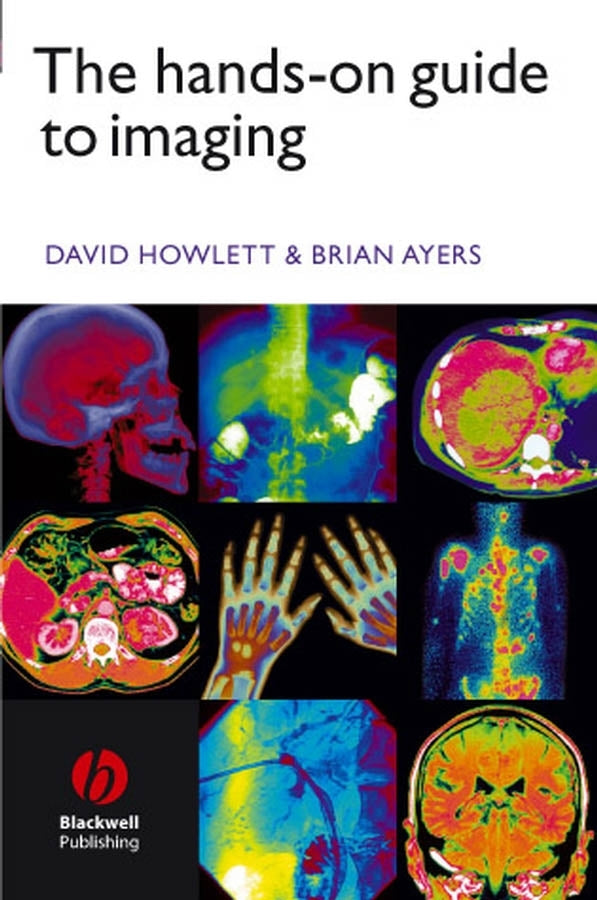 The Hands-on Guide to Imaging (Paperback / softback) 9781405115513