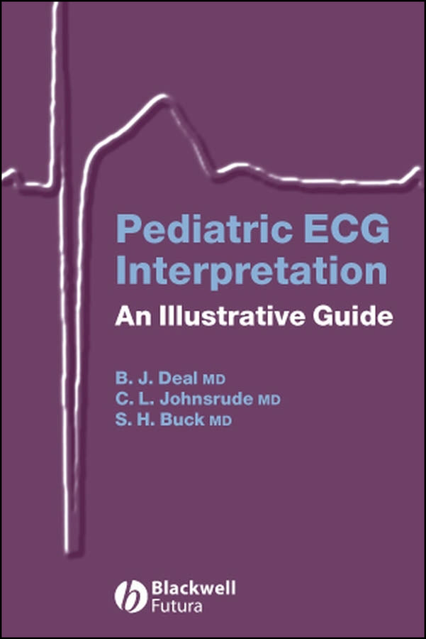 Pediatric ECG Interpretation; An Illustrative Guide (Spiral bound) 9781405117302