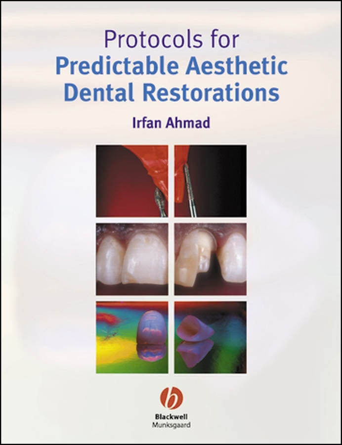 Protocols for Predictable Aesthetic Dental Restorations (Paperback / softback) 9781405118200