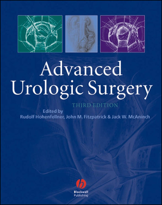 Advanced Urologic Surgery (Hardback) 9781405122139