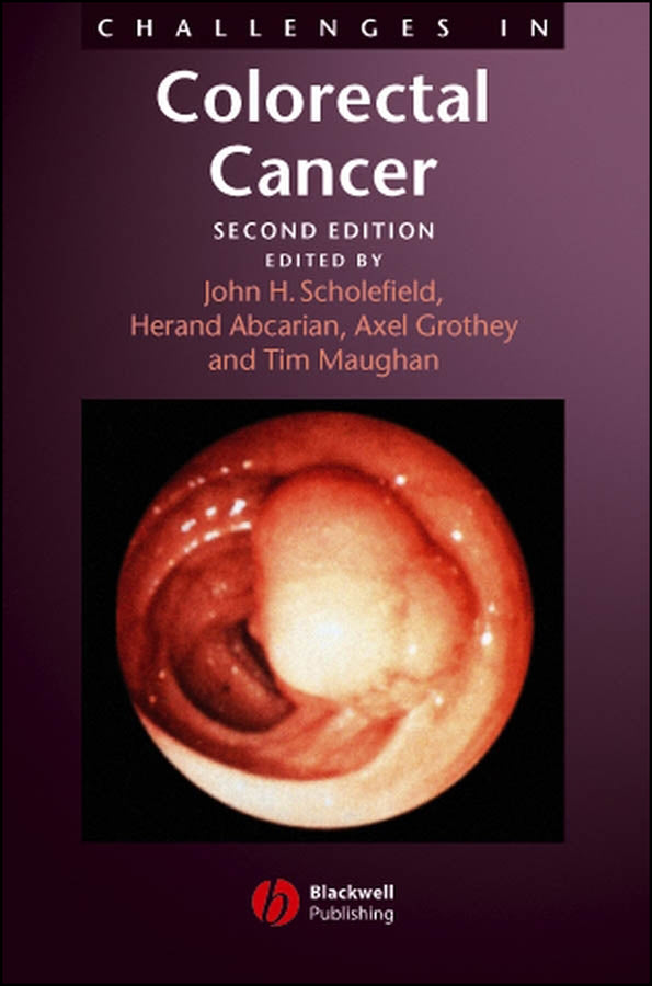 Challenges in Colorectal Cancer (Hardback) 9781405127066