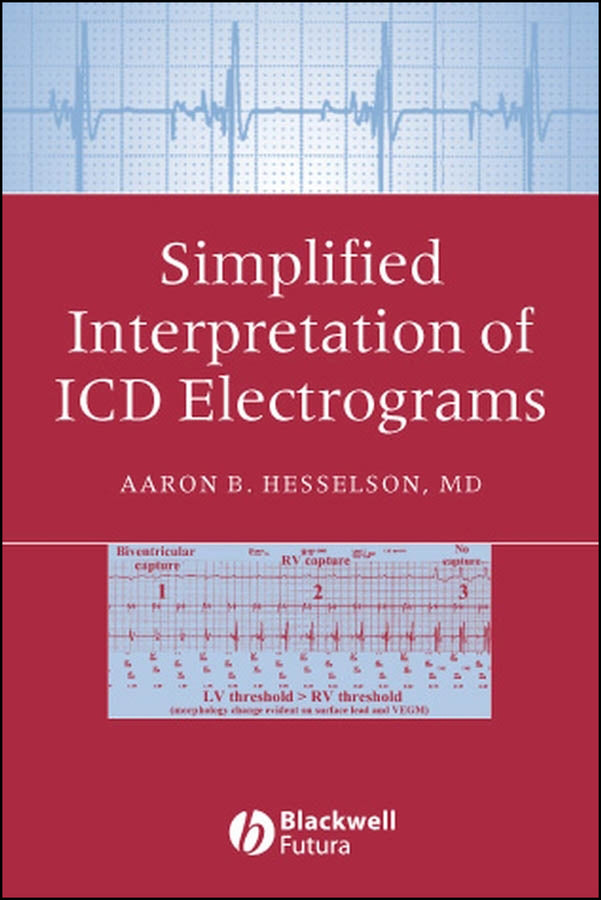 Simplified Interpretation of ICD Electrograms (Paperback / softback) 9781405127318