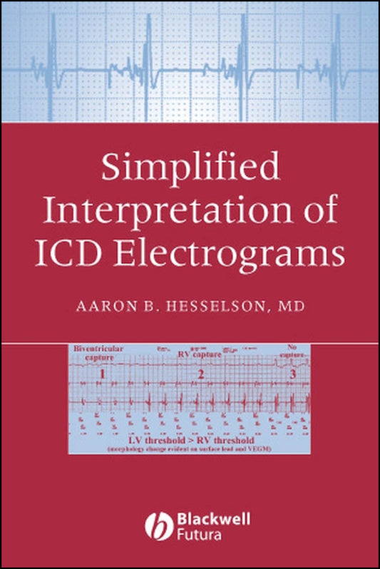 Simplified Interpretation of ICD Electrograms (Paperback / softback) 9781405127318