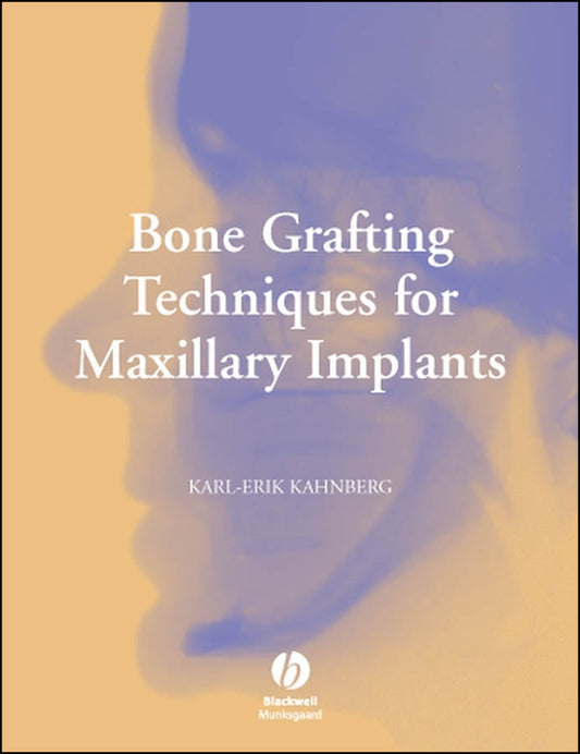 Bone Grafting Techniques for Maxillary Implants (Hardback) 9781405129947