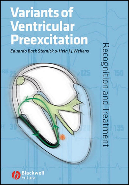 Variants of Ventricular Preexcitation; Recognition and Treatment (Hardback) 9781405148436