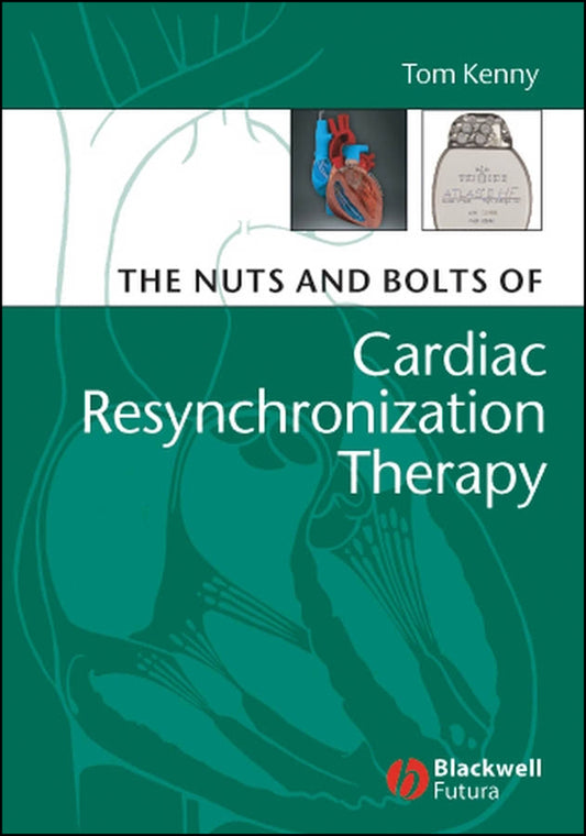 The Nuts and Bolts of Cardiac Resynchronization Therapy (Paperback / softback) 9781405153720