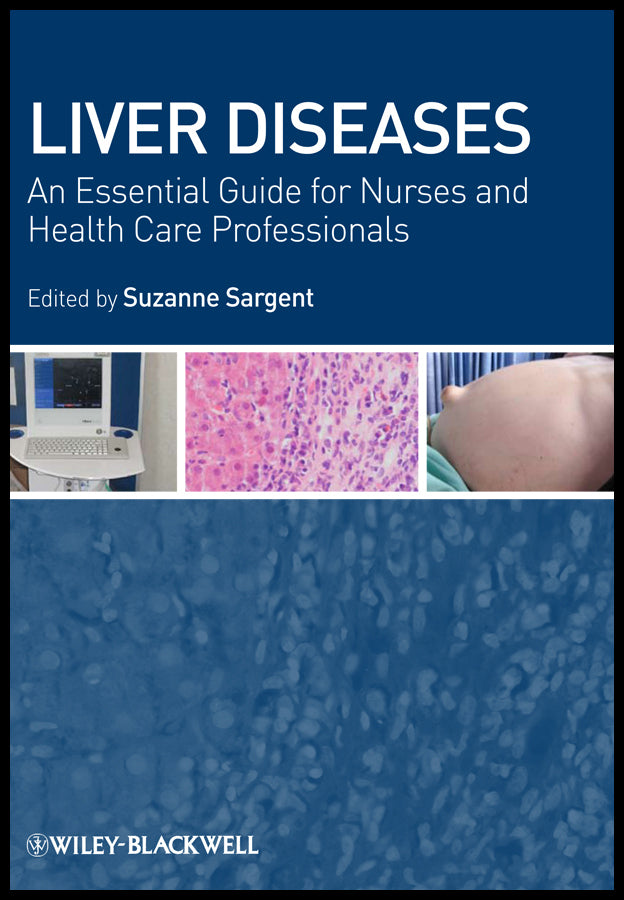 Liver Diseases; An Essential Guide for Nurses and Health Care Professionals (Paperback / softback) 9781405163064